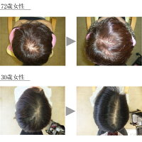ふんわり女髪美トリートメント1000ml詰替え用リンス薄毛予防ハリコシボリューム発毛促進細胞賦活血流促進女性レディースプレゼント頭皮ボタニカルキレイ潤い