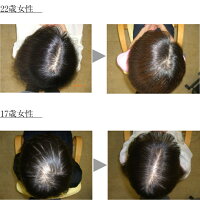 ふんわり女髪美トリートメント1000ml詰替え用リンス薄毛予防ハリコシボリューム発毛促進細胞賦活血流促進女性レディースプレゼント頭皮ボタニカルキレイ潤い