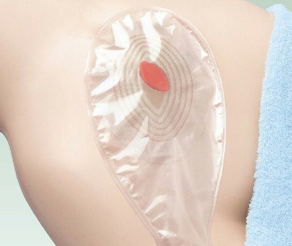 ウエルケア ドレーン S 15831 袋サイズ160mmx95mm 有効怪35mm 1函入数5枚 アルケア【返品不可】