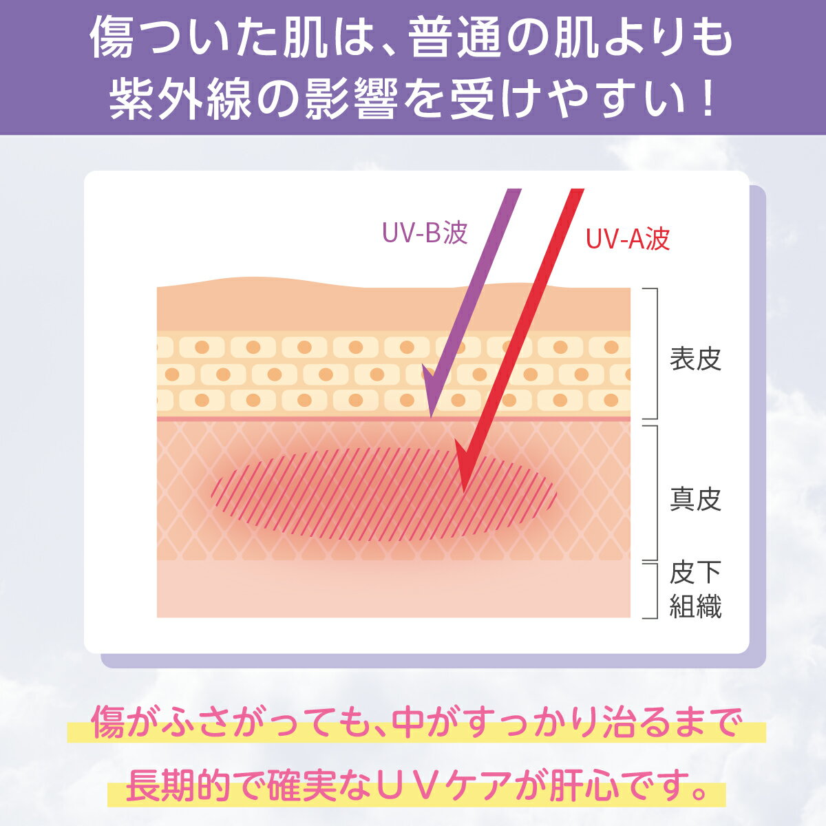 skinix エアウォールUV 19mm×3m 97% UVブロック 貼る 日焼け止め UVカット 防水フィルム テープ 透明 1巻 MA-E3019-U【返品不可】