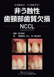 Dentistry - 非う蝕性歯頸部歯質欠損NCCL なぜ起きる?どう対応する?