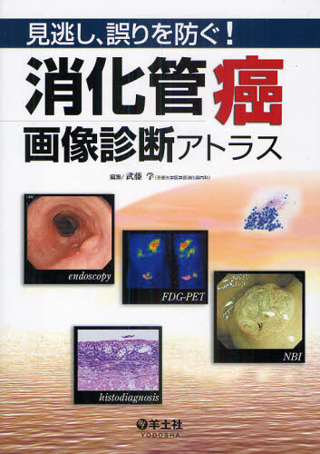 見逃し、誤りを防ぐ!消化管癌画像診断アトラス