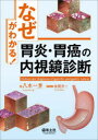 「なぜ」がわかる!胃炎・胃癌の内視鏡診断