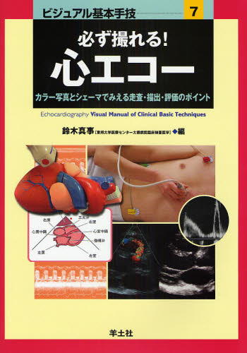 必ず撮れる!心エコー カラー写真とシェーマでみえる走査・描出・評価のポイント
