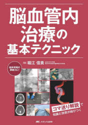 脳血管内治療の基本テクニック