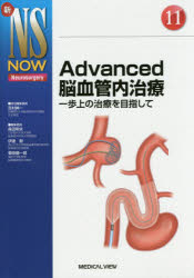 Advanced脳血管内治療 一歩上の治療を目指して