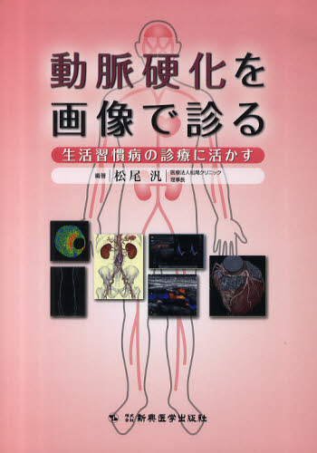 動脈硬化を画像で診る 生活習慣病の診療に活かす