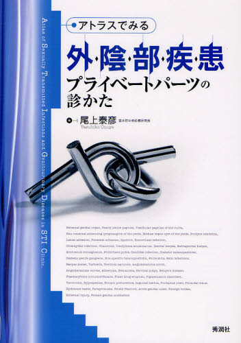 尾上泰彦／著本詳しい納期他、ご注文時はご利用案内・返品のページをご確認ください出版社名学研メディカル秀潤社出版年月2010年10月サイズ191P 26cmISBNコード9784780908305医学 臨床医学内科系 皮膚科学アトラスでみる外陰部疾患プライベートパーツの診かたアトラス デ ミル ガイインブ シツカン プライベ-ト パ-ツ ノ ミカタ※ページ内の情報は告知なく変更になることがあります。あらかじめご了承ください登録日2013/04/09