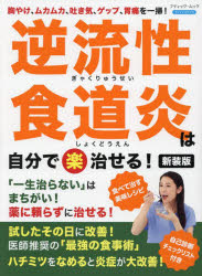 逆流性食道炎は自分で楽治せる 胸やけ ムカムカ 吐き気 ゲップ 胃痛を一掃