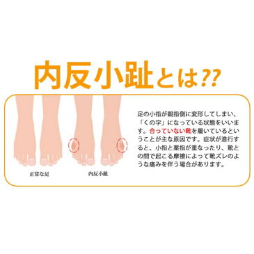 内反小趾 やわらかパッド 2足組 予防 足ケア用品 バレエ 靴ずれ まめ トウシューズ ポアント ダンス パンプス シリコン 痛くない