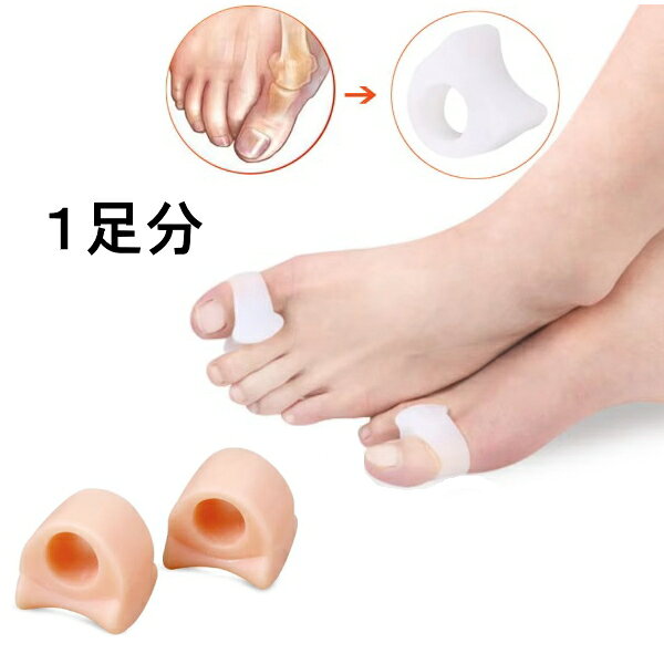 外反母趾や巻き爪でお悩みのあなたに！ 装着していても目立たない肌色のセパレーターです。 足の親指と人差し指の間に挟んで　親指が内側に曲がってしまうのを矯正するシリコン製のセパレーターです。 柔らかいよく伸びるシリコンでできているから　 長い時間付けていても圧迫されるような窮屈感はありません。 バレエを習っている方は外反母趾や巻き爪でお悩みの方も多いはず。 普段の生活から外反母趾対策されると　バレエのレッスンを痛みなく快適に行うことができます。 フリーサイズですので子供〜大人までご利用可能。 汚れたら中性洗剤で水洗いも可能。 足のトラブルにお悩みのあなたに贈る　トウセパレーター♪ ぜひお試しください。 カラー ●ヌード　ベージュ サイズ ●約2.5x2.5cm 素材 ●ソフトシリコン製 生産国 ●中国製 お洗濯 ●水洗いOK 関連商品 ●外反母趾や内反小趾グッズ各種ご用意しています。 注意点 ●ネコポスで8個まで発送可能です。就寝時の利用はおやめください。