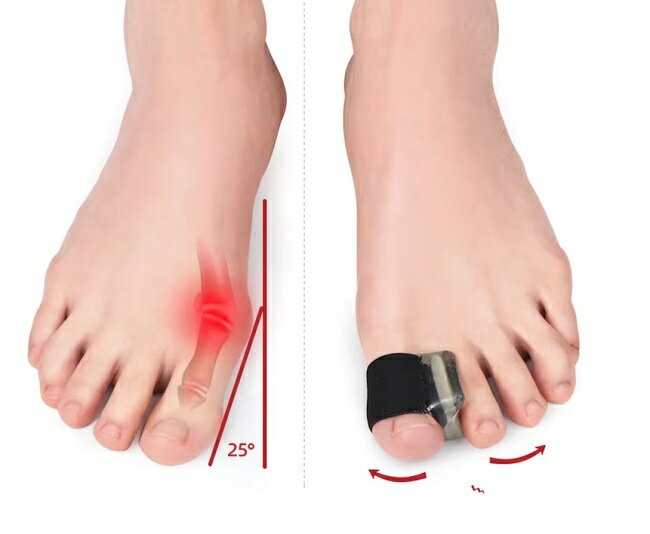 ­�ؤ˥ե��å� ��ȿ���桡�Х˥���ѥåɡ����ä���ؤȻؤδ֤˶��֤���ޤ�(1­ʬ�ˡں���ʬ�� �ȥ����塼�����ݥ��ȡ��ѥ�ץ����ȥ����塼�����Х쥨���ߥ˥��ͽ�ɡ��ե꡼������