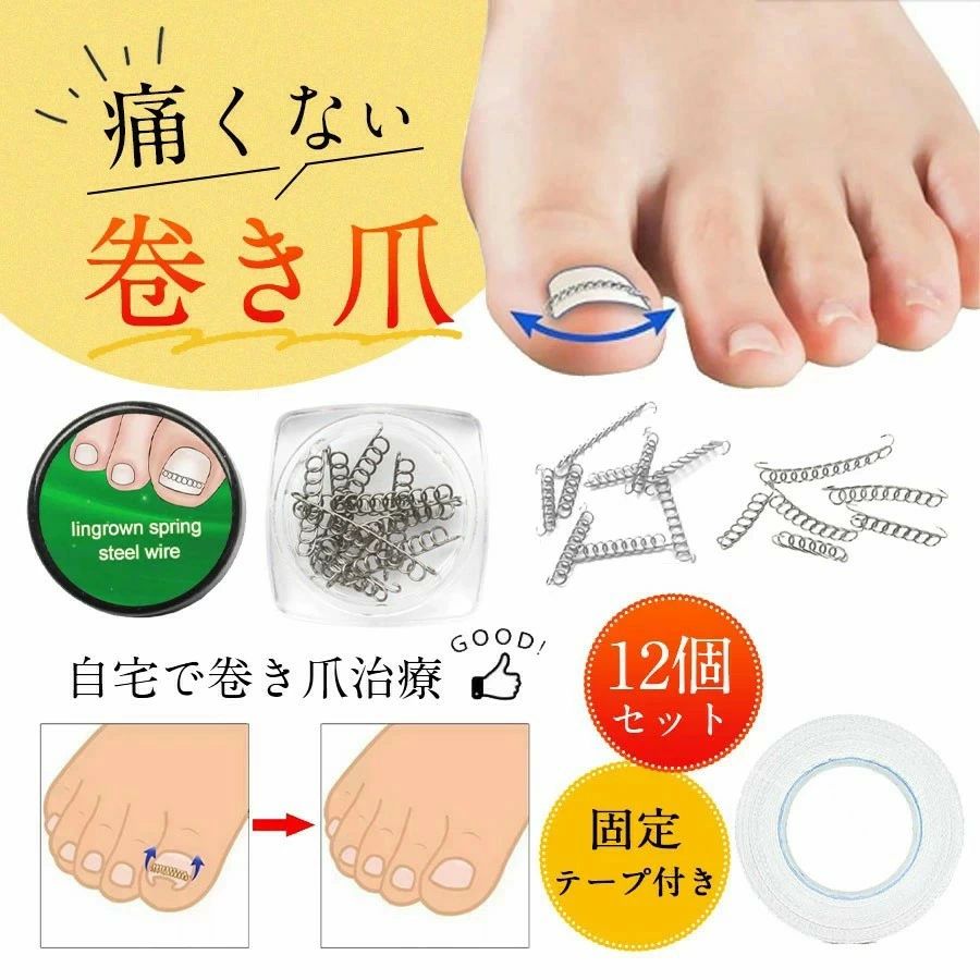 爪ワイヤー 矯正器具 矯正 治療 自宅で治す セルフケア ネイルエイド サポーター テープ付き 巻き爪チェーン 12個 爪切り