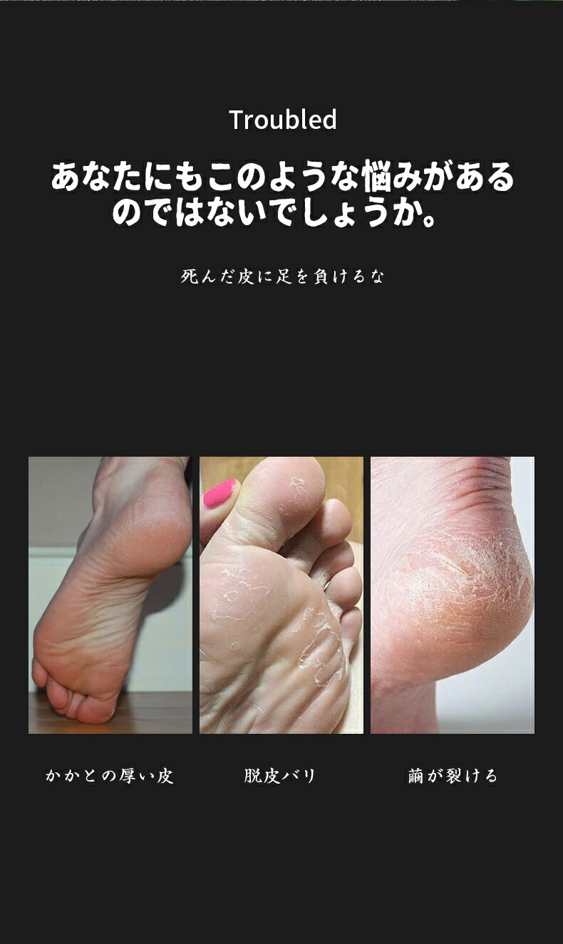 MITOcolor shop 楽天市場店の【送料無料 】ROLYPOLY多機能バスフットケアツール 簡単に足の健康をケア 一日の疲れを癒す入浴時に、同時に足をケア 夏にサンダルを履く前に角質ケアで自信のある足元に 誕生日やお祝いギフトとして、大切な人への健康をプレゼント｜アングル2