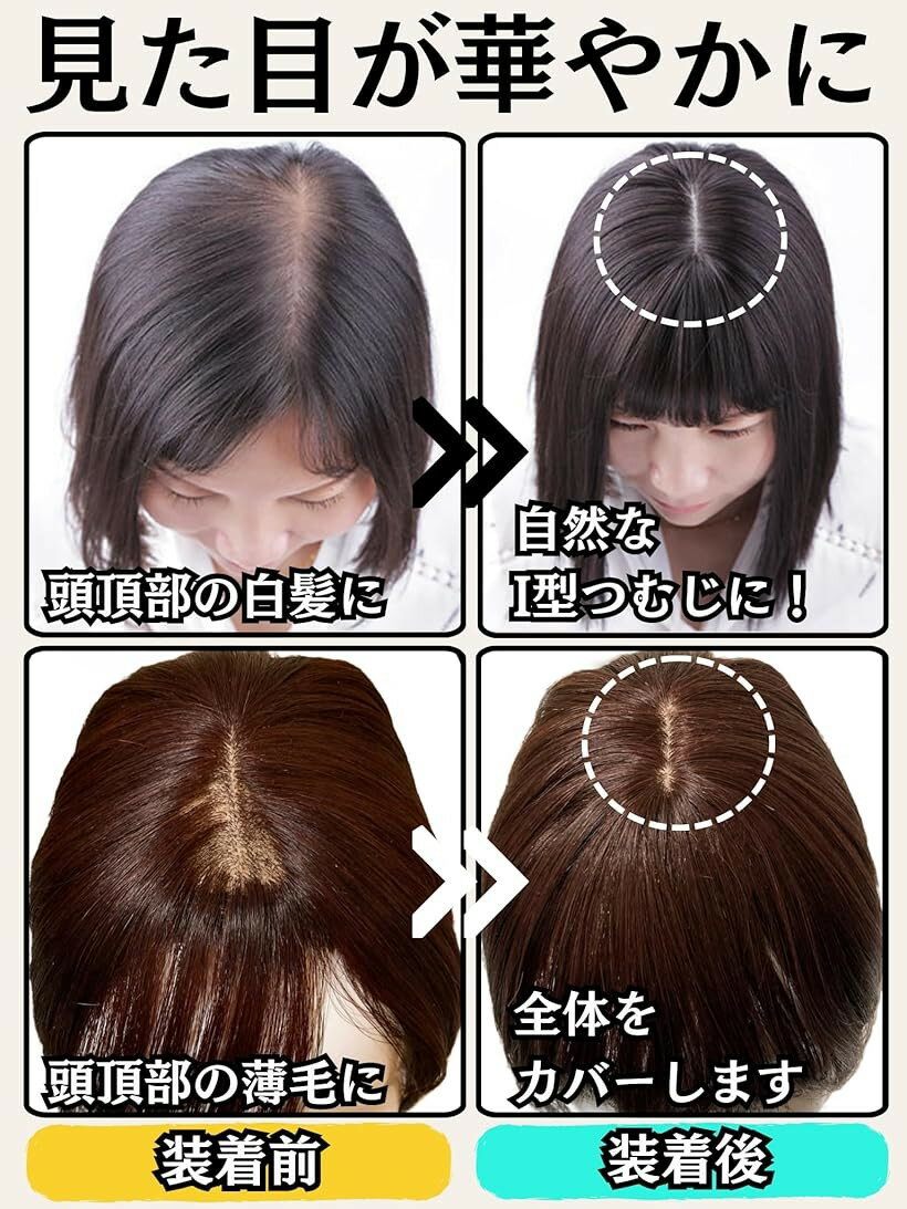 部分ウィッグ かつら ヘアピース ポイントウィッグ 女性 レディース 人毛100% ショート 前髪 ストレート 前髪ウィッグ I型つむじ 医療用 頭頂部 必需品3点セットカツラ うぃっぐ モカブラウン (モカブラウン（人毛), free) 2