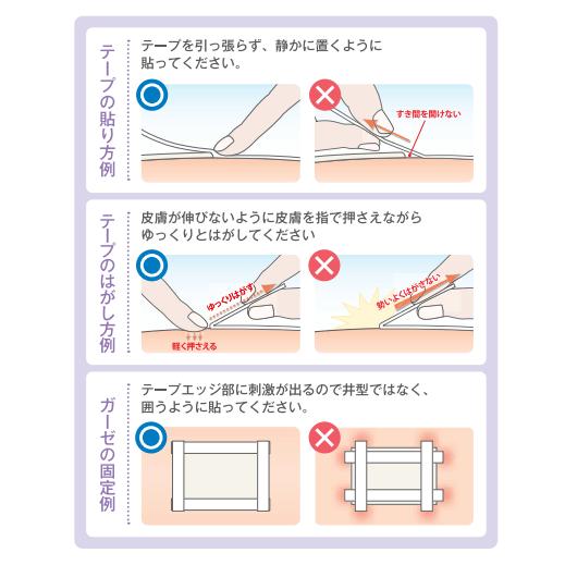 【楽天スーパーSALE P2倍 】 全国送料無料 ＼2個購入で50円OFF／【25mm OR 12mm】医療用テープ スキナゲート 12mm24巻 25mm12巻 ニチバン サージカルテープ 超低刺激 まつ毛 超低刺激 低刺激 肌に優しい 医療用 赤ちゃん 絆創膏 SG12 SG25 ばんそうこう