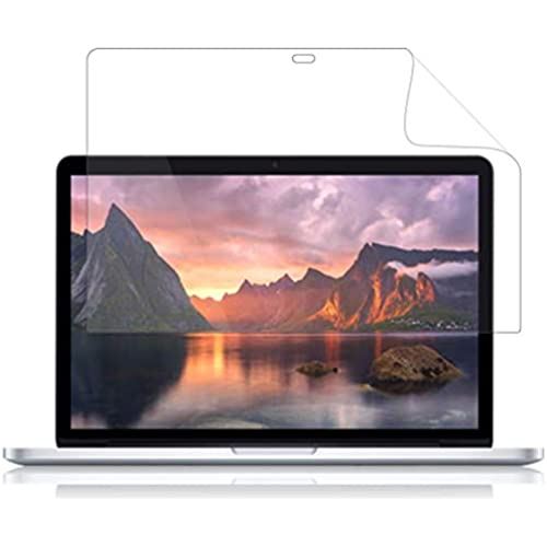  MacBook Pro 13 (2015) یtB ܂œ\ĂȂ̂悤ɔ  ɒᔽ SARtB  MacBook Pro 13 (2016N10ȑO)