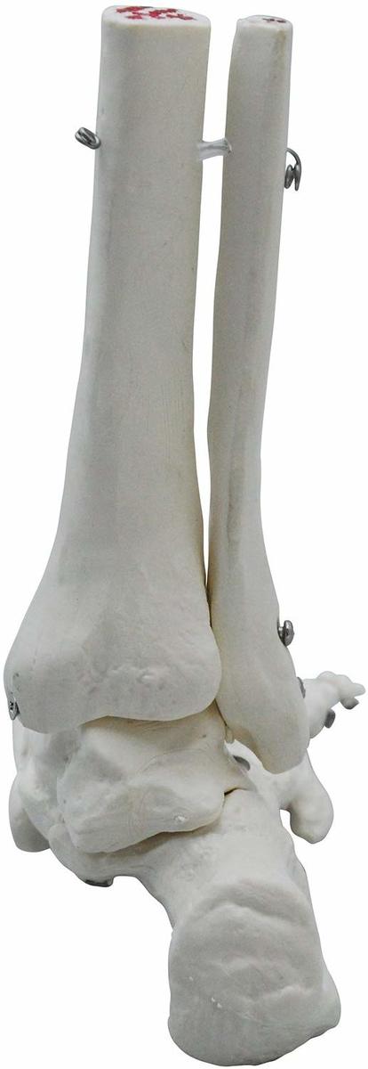 距腿関節からショパール関節 リスフラン関節までリアルに再現 足骨モデル 足骨模型 足関節模型 標本 足首 超大特価 固定タイプ 右足