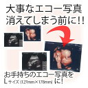 【エコー写真のプリント】Lサイズ(89×127mm)でのお仕上げ。