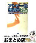 【中古】 アトピー性皮膚炎・克服への近道 ステロイド外用薬の誤解を解く / 竹原 和彦 / 小学館 [新書]【宅配便出荷】