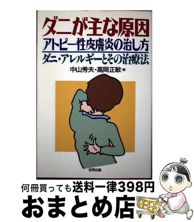 肌触りがいい ダニが主な原因 アトピー性皮膚炎の治し方 ダニ アレルギーとその治療法 中山 秀夫 高岡 正敏 合同出版 単行本 宅配便出荷 公式の Www Blokeliucentras Lt 肌触りがいい ダニが主な原因 アトピー性皮膚炎の治し方 ダニ アレルギーとその治療法 中山 秀夫 高岡 正敏 合同出版 単行本 宅配便出荷 公式の Www Blokeliucentras Lt