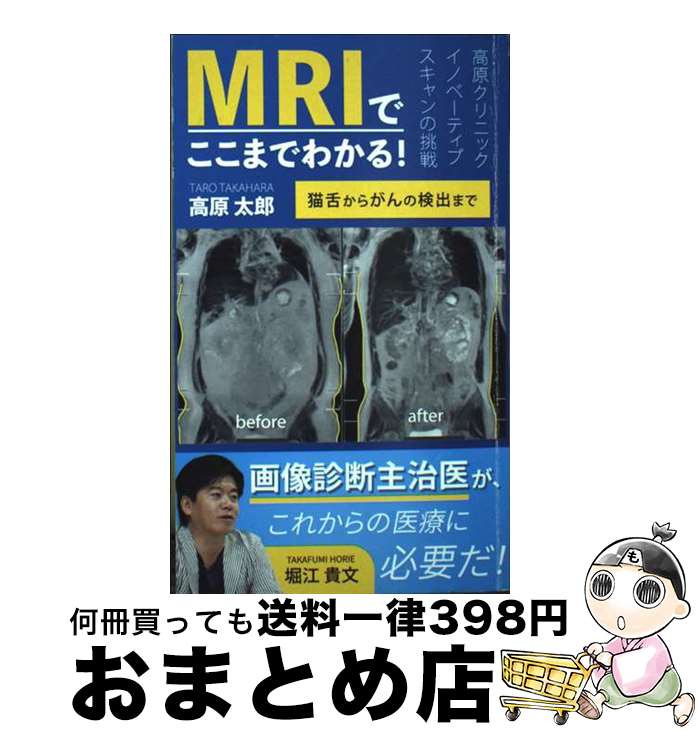 【中古】 MRIでここまでわかる！猫舌からがんの検出まで 高原クリニックイノベーティブスキャンの挑戦 / 高原太郎 新書 新書 / 高原 太郎 / ホリエモン出版 [新書]【宅配便出荷】