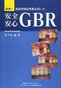 【中古-非常に良い】 図解! 遅延型吸収性膜を用いた 安全安心GBR(3)