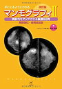 【未使用】【中古】 マンモグラフィII 改訂版 読影力をアップさせる厳選62例 解説強化・症例追加版 (手にとるようにわかる)