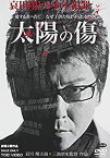 【中古】【輸入品・未使用】太陽の傷 [DVD]