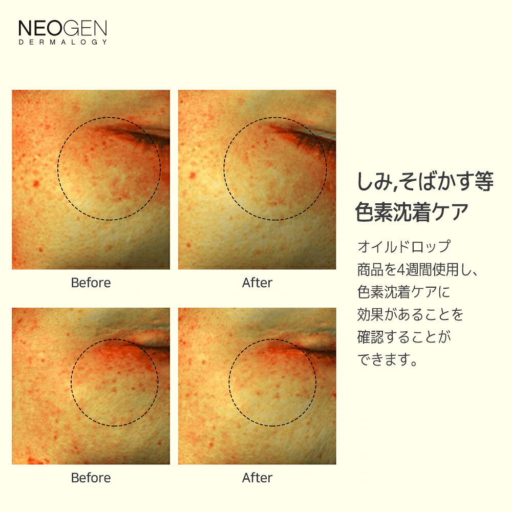 【NEOGEN公式】「ホワイトトリュフセラムインオイルドロップ 50ml」 美容液 キメ ツヤ くすみケア 高保湿 うるおい ふっくら 肌の 浸透 弾力 くすみ除去 色素沈着 韓国コスメ コスメ neogen-10000214 NEOGEN楽天市場店 サンプル画像3