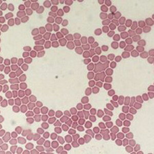 ケニス 血液型 プレパラート 4種類 各1枚 (1-157-0385) 血液を顕微鏡観察しよう!! ※お取り寄せ商品です。