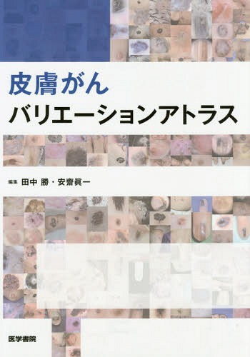 皮膚がんバリエーションアトラス[本/雑誌] / 田中勝/編集 安齋眞一/編集のサムネイル