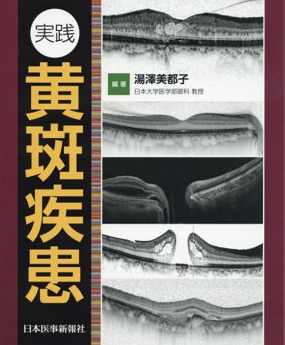 実践黄斑疾患[本/雑誌] / 湯澤美都子/編著