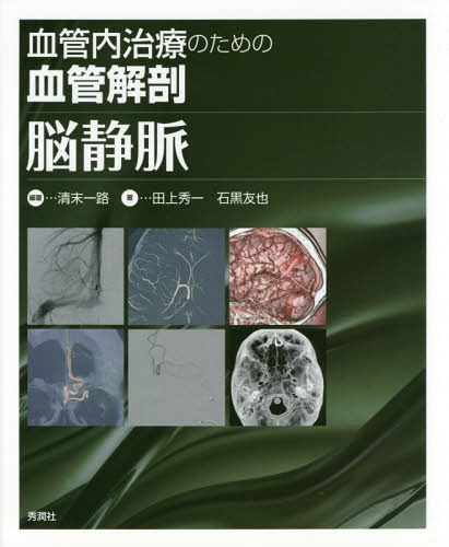 血管内治療のための血管解剖脳静脈[本/雑誌] / 清末一路/編著 田上秀一/著 石黒友也/著