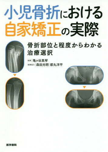 小児四肢骨折治療の実際 | 井上博(整形外科学) |本 | 通販 | Amazon