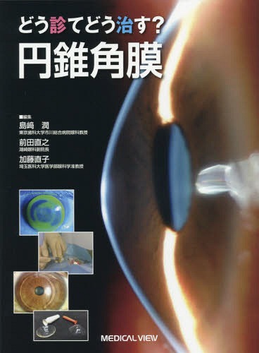 どう診てどう治す?円錐角膜[本/雑誌] / 島崎潤/編集 前田直之/編集 加藤直子/編集