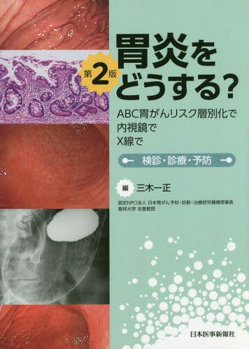胃炎をどうする? ABC胃がんリスク層別化で内視鏡でX線で 検診・診療・予防[本/雑誌] / 三木一正/編のサムネイル