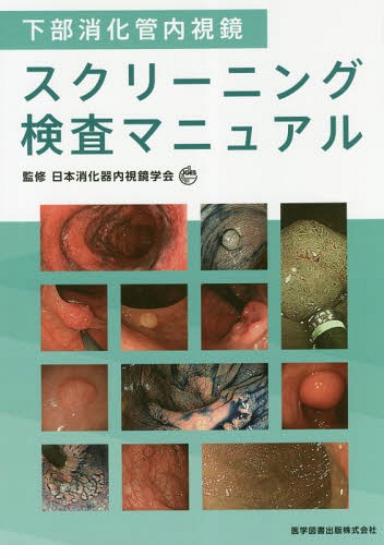 下部消化管内視鏡スクリーニング検査マニュ[本/雑誌] / 日本消化器内視鏡学会/監修