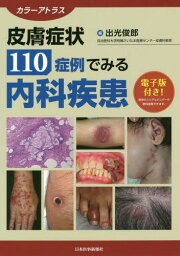 皮膚症状110症例でみる内科疾患 カラーアトラス[本/雑誌] / 出光俊郎/編