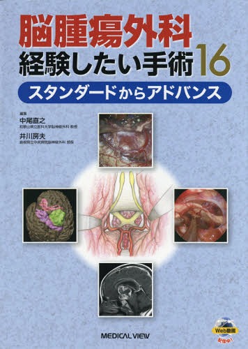 脳腫瘍外科経験したい手術16 スタンダードからアドバンス[本/雑誌] / 中尾直之/編集 井川房夫/編集