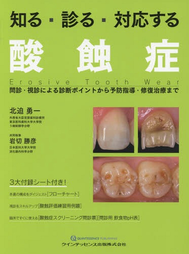 ご注文前に必ずご確認ください＜商品説明＞＜商品詳細＞商品番号：NEOBK-2136681Kita Sako Yuichi / Cho Iwakiri Katsuhiko / Kyodo Shippitsu / Shiru Miru Taio Suru San Shiyokushiyo Monshin Shishin Ni Yoru Shindan Pointo Kara Yobo Shido Shiyufuku Chiriyo Madeメディア：本/雑誌重量：566g発売日：2017/09JAN：9784781205694知る・診る・対応する酸蝕症 問診・視診による診断ポイントから予防指導・修復治療まで[本/雑誌] / 北迫勇一/著 岩切勝彦/共同執筆2017/09発売