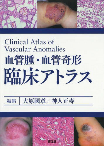 血管腫・血管奇形臨床アトラス[本/雑誌] / 大原國章/編集 神人正寿/編集