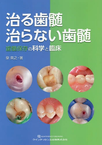 治る歯髄治らない歯髄 歯髄保存の科学と臨床[本/雑誌] / 泉英之/著