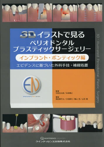 [書籍のゆうメール同梱は2冊まで]/3Dイラストで見るペリオドンタルプラスティックサージェリー インプラント・ポンティック編[本/雑誌] / 中田光太郎/監著 木林博之/監著 岡田素平太/著 小田師巳/著 園山亘/著 山羽徹/著