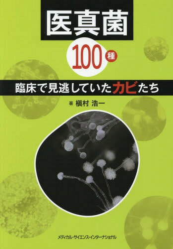 医真菌100種 臨床で見逃していたカビた[本/雑誌] / 槇村浩一/著(3)