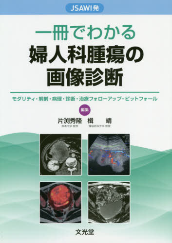 一冊でわかる婦人科腫瘍の画像診断[本/雑誌] (JSAWI発