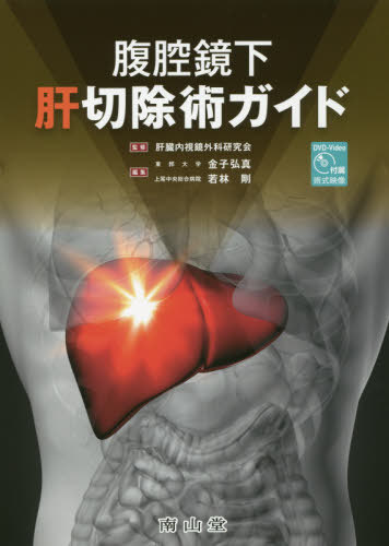 腹腔鏡下肝切除術ガイド[本/雑誌] / 肝臓内視鏡外科研究会/監修 金子弘真/編集 若林剛/編集 金子弘真/〔ほか〕執筆