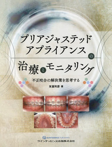 プリアジャステッドアプライアンスの治療とモニタリング 不正咬合の解決策を思考する[本/雑誌] / 氷室利彦/著