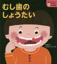 むし歯のしょうたい[本/雑誌] (知ってびっくり!歯のひみつがわかる絵本) / 楠章子/文 ながおかえつこ/絵