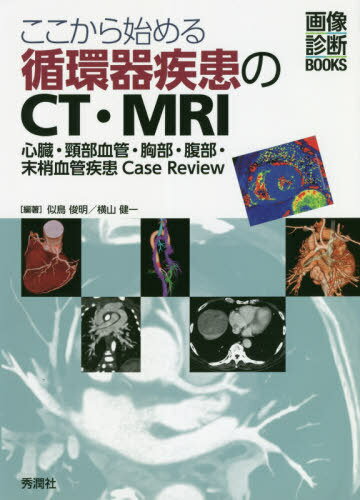 ここから始める循環器疾患のCT・MRI 心臓・頸部血管・胸部・腹部・末梢血管疾患Case Review[本/雑誌] (画像診断BOOKS) / 似鳥俊明/編著 横山健一/編著